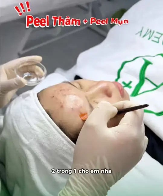 Đàn ông hiện đại không ngại chăm da